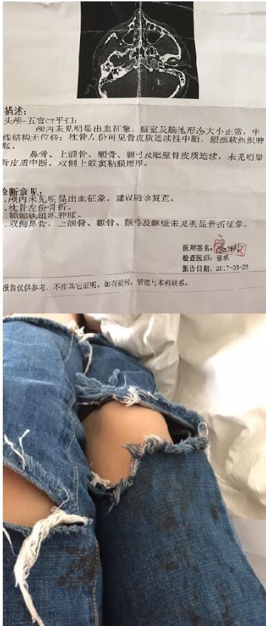 网友发微博称在云南被打 警方：打人者已被抓获